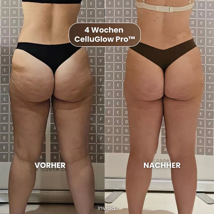 Anti-cellulite massageapparaat
